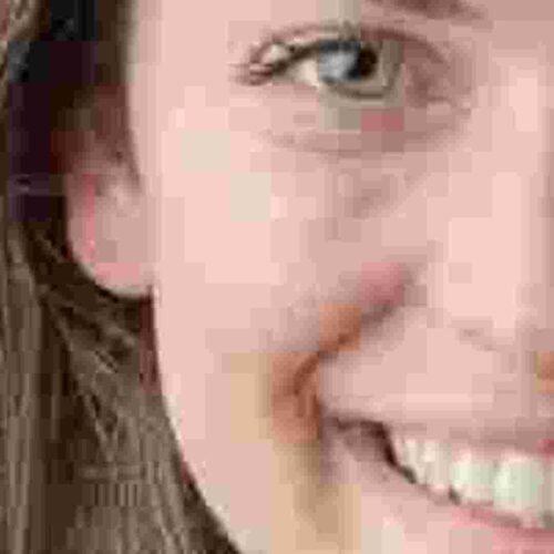 Obraz przedstawia zbliżenie twarzy tak, aby widoczne były kąciki ust i oczu niezbędne do wykonania portretu ze zdjęcia. Na zdjęciu widać, że elementy te jak i całe zdjęcie po powiększeniu są niewyraźne. Jest to przykład zdjęcia o niskiej jakości. Powiększone zostało zdjęcie wykonane z bliska.